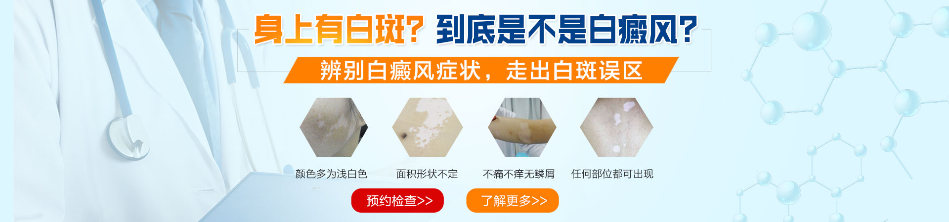苏州银康白癜风医院banner